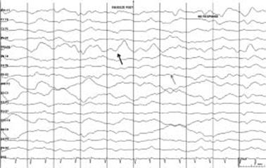 Figure 1.4