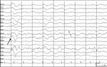 Figure 1.3