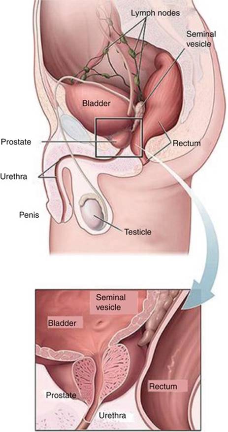 A328700_1_En_17_Fig1_HTML.jpg