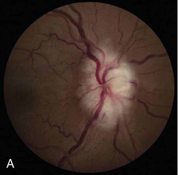 u11-04a-9781455776443