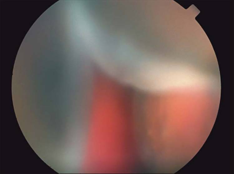 Click to view full size figure