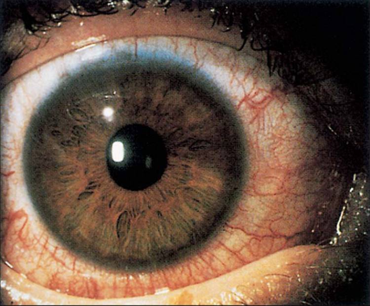 Click to view full size figure