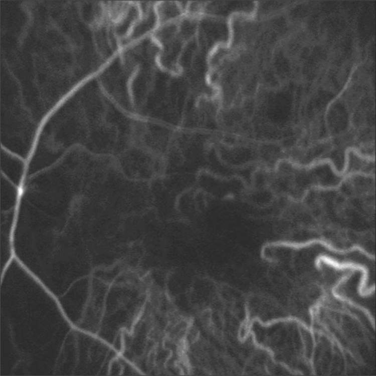 Click to view full size figure