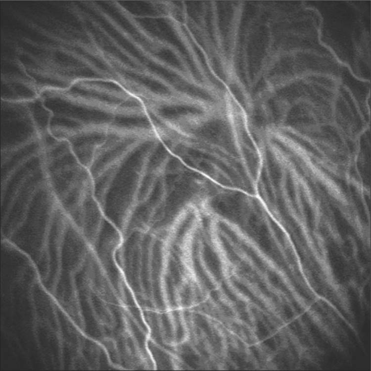 Click to view full size figure