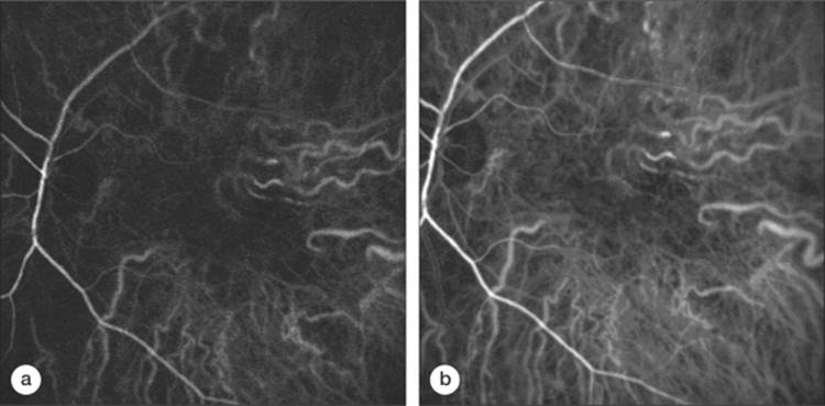 Click to view full size figure