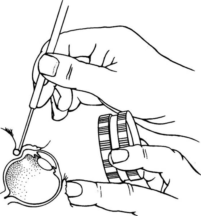 Click to view full size figure