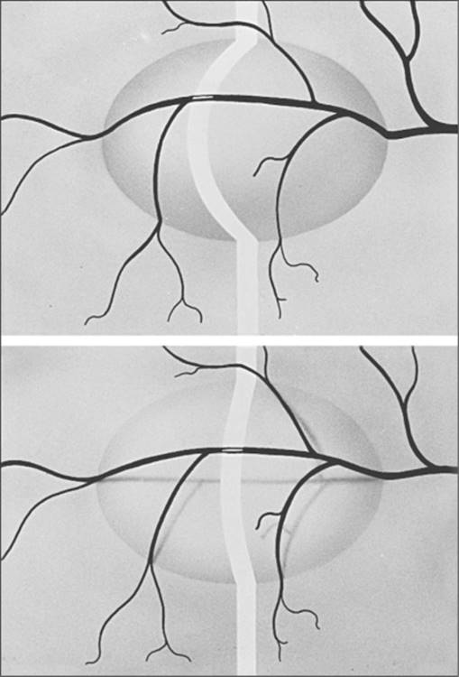 Click to view full size figure