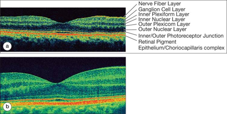 Click to view full size figure