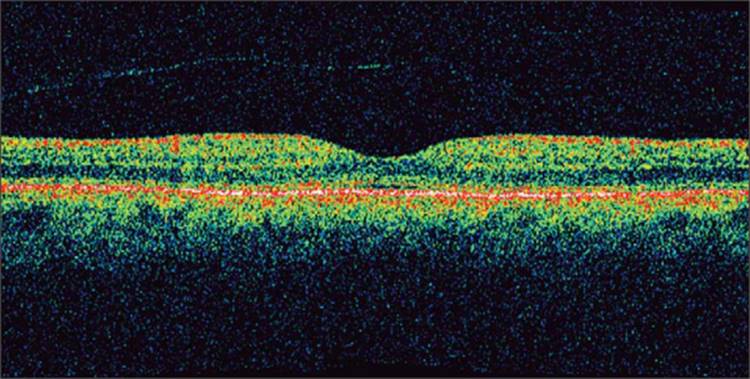 Click to view full size figure