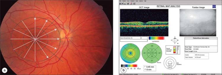 Click to view full size figure