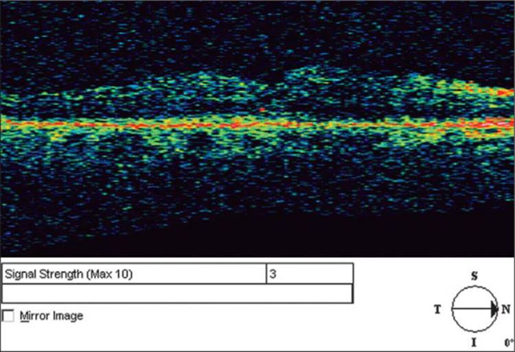 Click to view full size figure