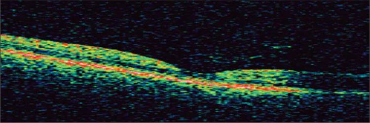 Click to view full size figure