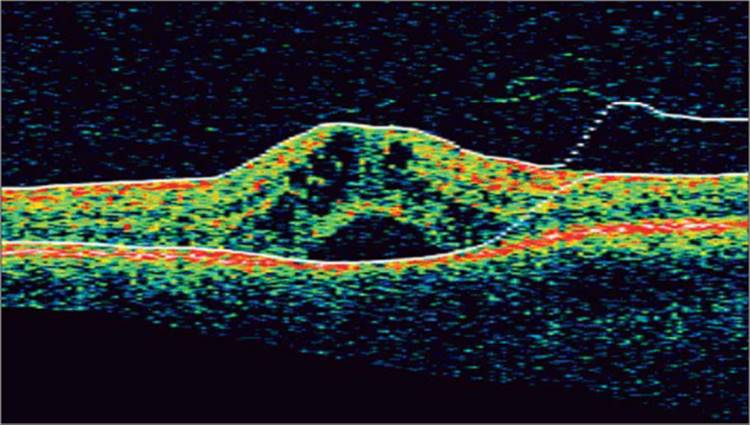 Click to view full size figure