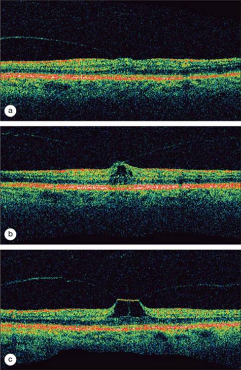 Click to view full size figure