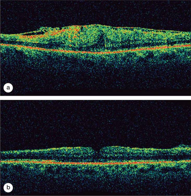 Click to view full size figure