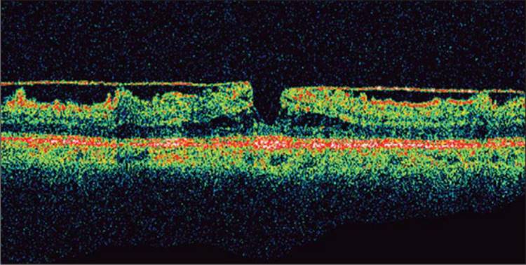 Click to view full size figure