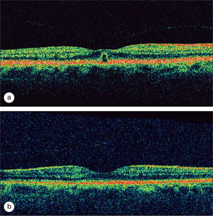 Click to view full size figure