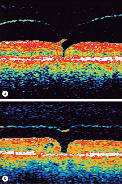 Click to view full size figure