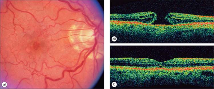 Click to view full size figure