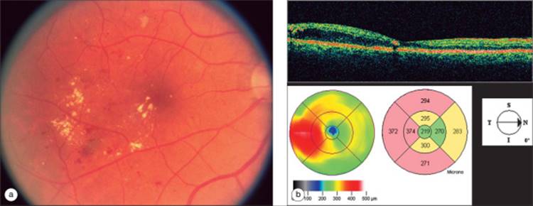 Click to view full size figure