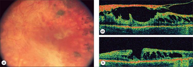 Click to view full size figure