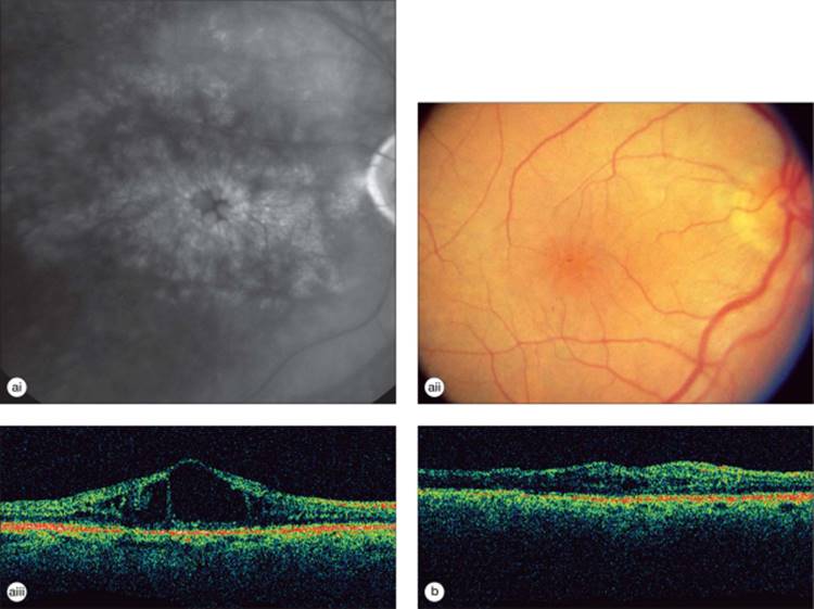 Click to view full size figure