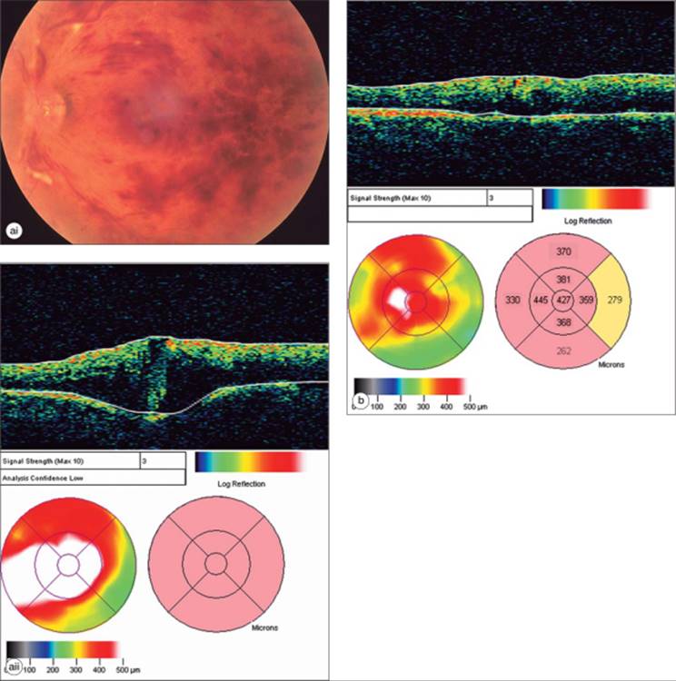 Click to view full size figure