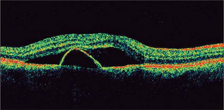 Click to view full size figure