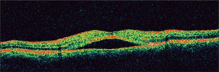 Click to view full size figure