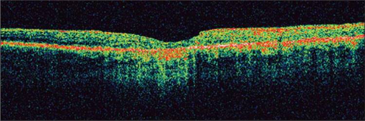 Click to view full size figure