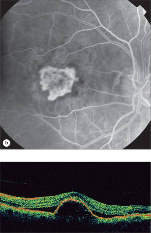 Click to view full size figure