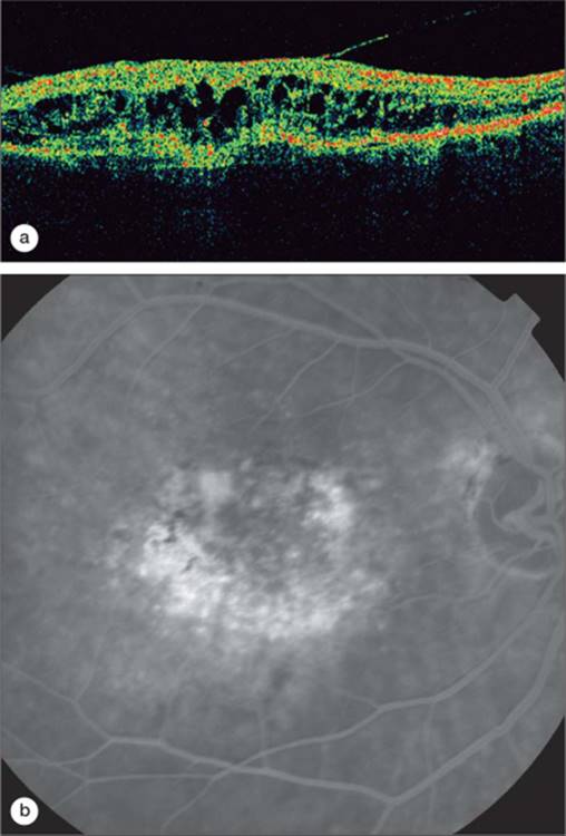 Click to view full size figure