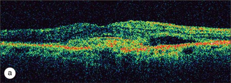 Click to view full size figure