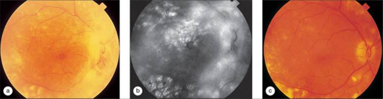 Click to view full size figure