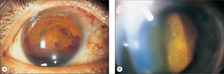 Click to view full size figure