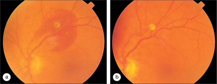 Click to view full size figure