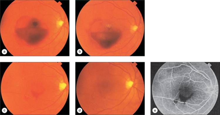 Click to view full size figure