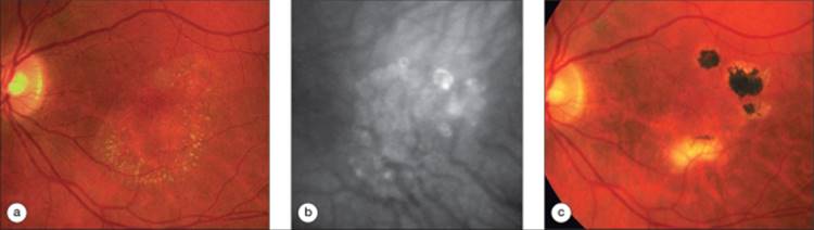 Click to view full size figure