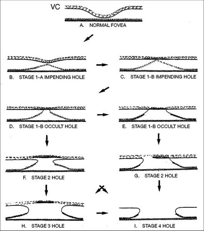 Click to view full size figure