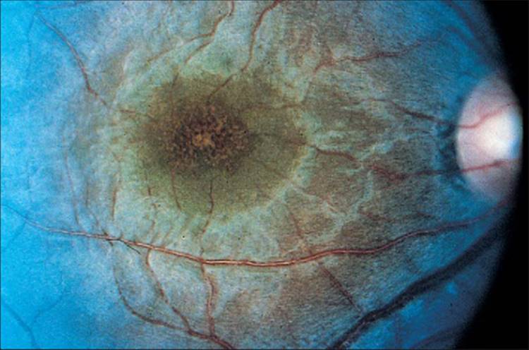 Click to view full size figure