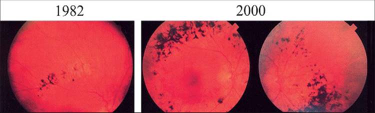 Click to view full size figure