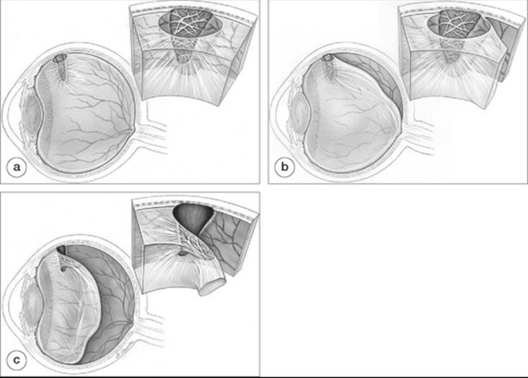 Click to view full size figure