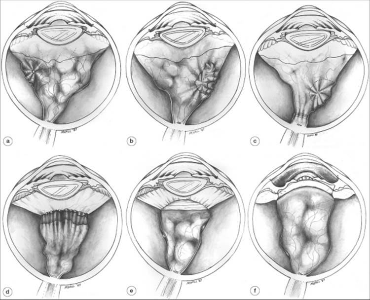 Click to view full size figure