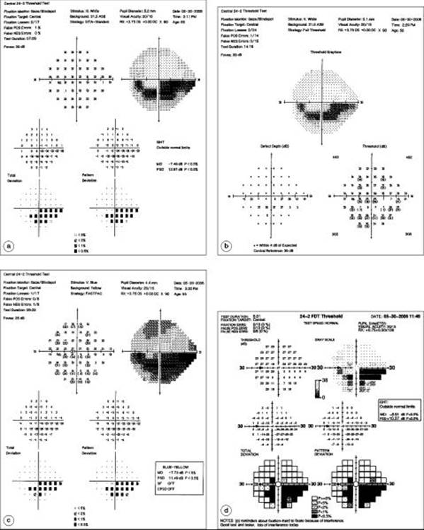 Click to view full size figure