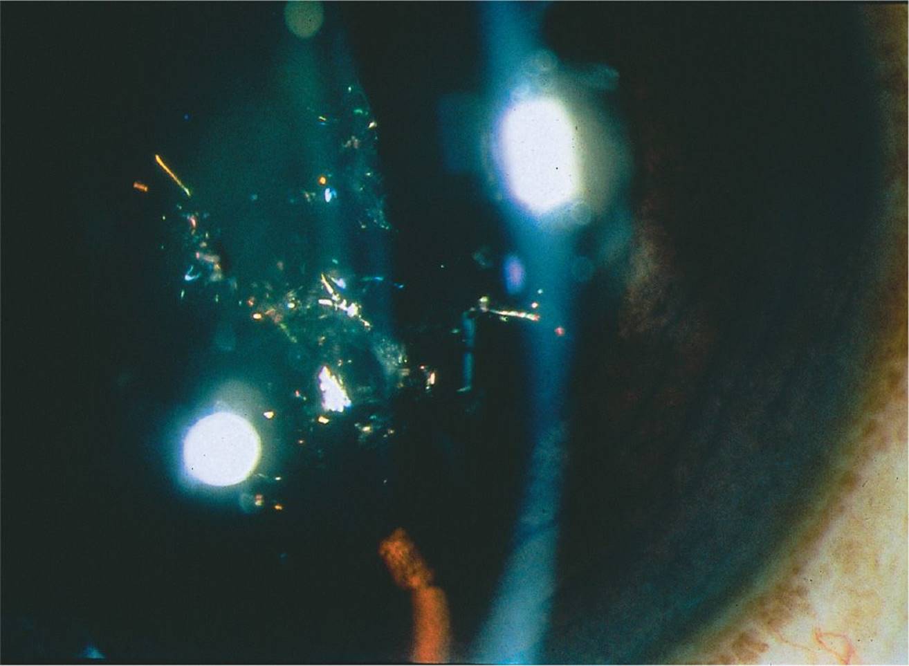 images