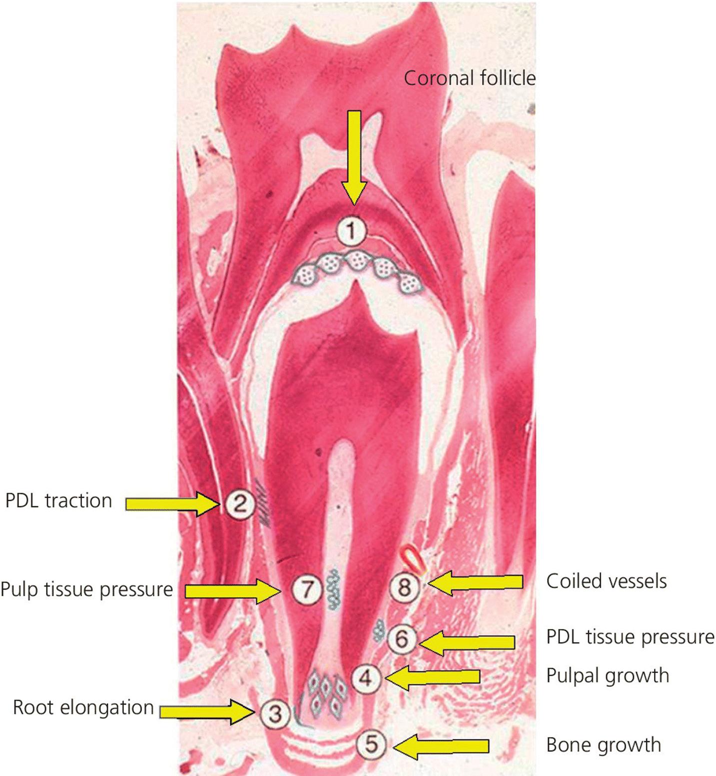 Micrograph displaying histologic section of a human second premolar in initial stage of eruption, with arrows denoting mechanisms in eruption pointing to numbers.