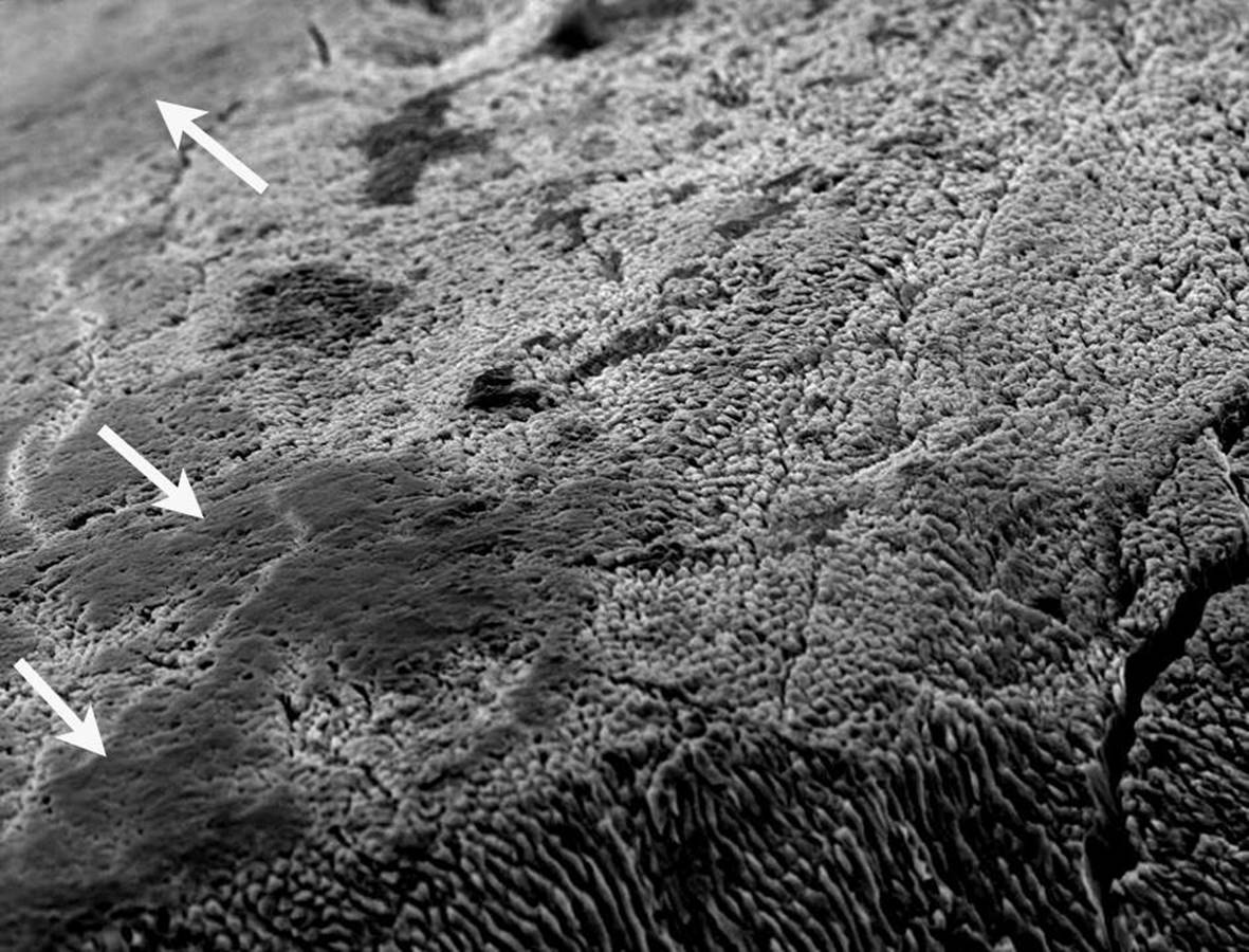 Scanning electron microscope image displaying enamel surface, with dark areas with organic material remain depicted by arrows.