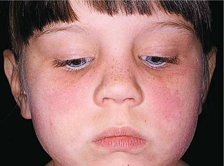 The Pediatric Patient - Textbook of Physical Diagnosis: History and ...
