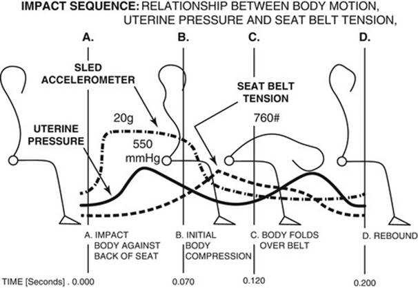 A322816_1_En_10_Fig7_HTML.jpg