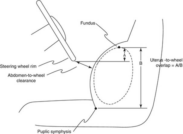 A322816_1_En_10_Fig10_HTML.jpg